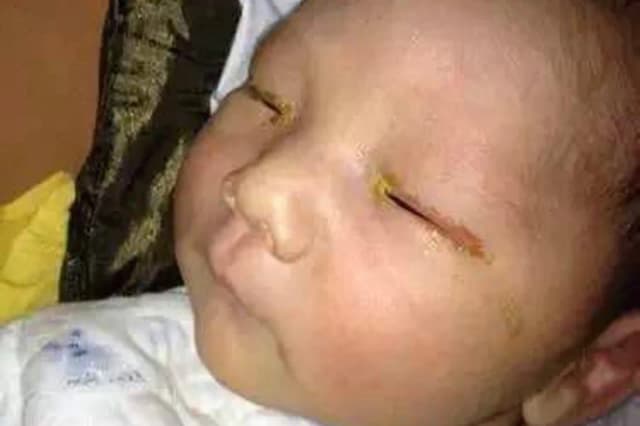 Lampa błyskowa a wzrok noworodka: Prawda o bezpieczeństwie fotografowania Lampa błyskowa a wzrok noworodka: Prawda o bezpieczeństwie fotografowania